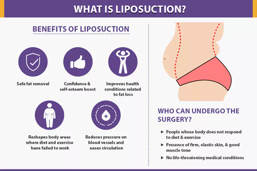 benefits of liposuction
