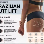 Brazilian Butt Lift Surgery