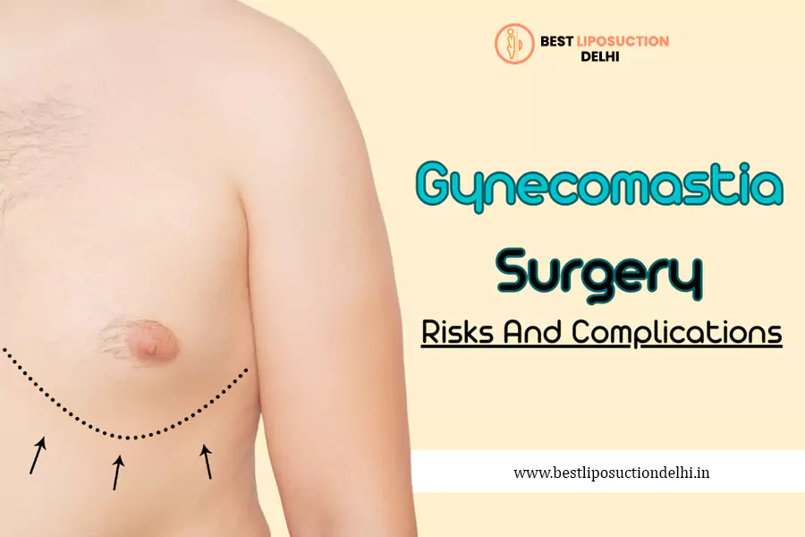 Gynecomastia Surgery Risks