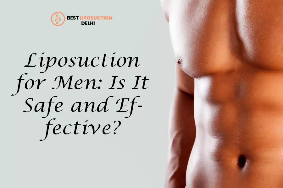 Liposuction for Men