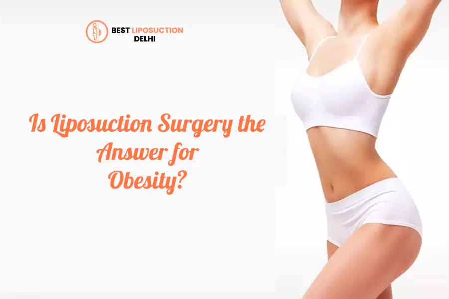 liposuction vs bariatric