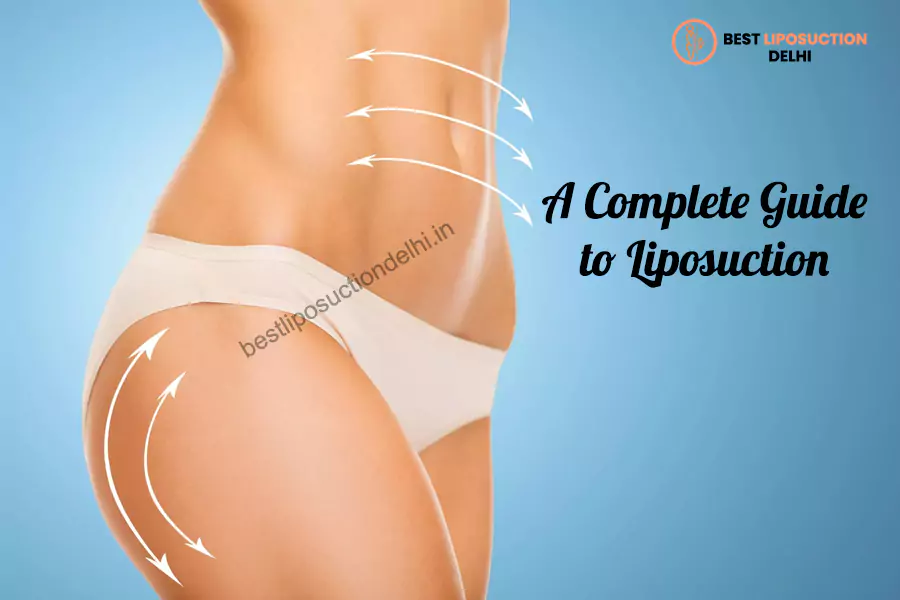 liposuction