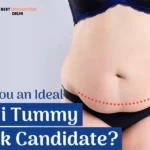 Tummy Tuck