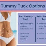 Tummy Tuck Surgery