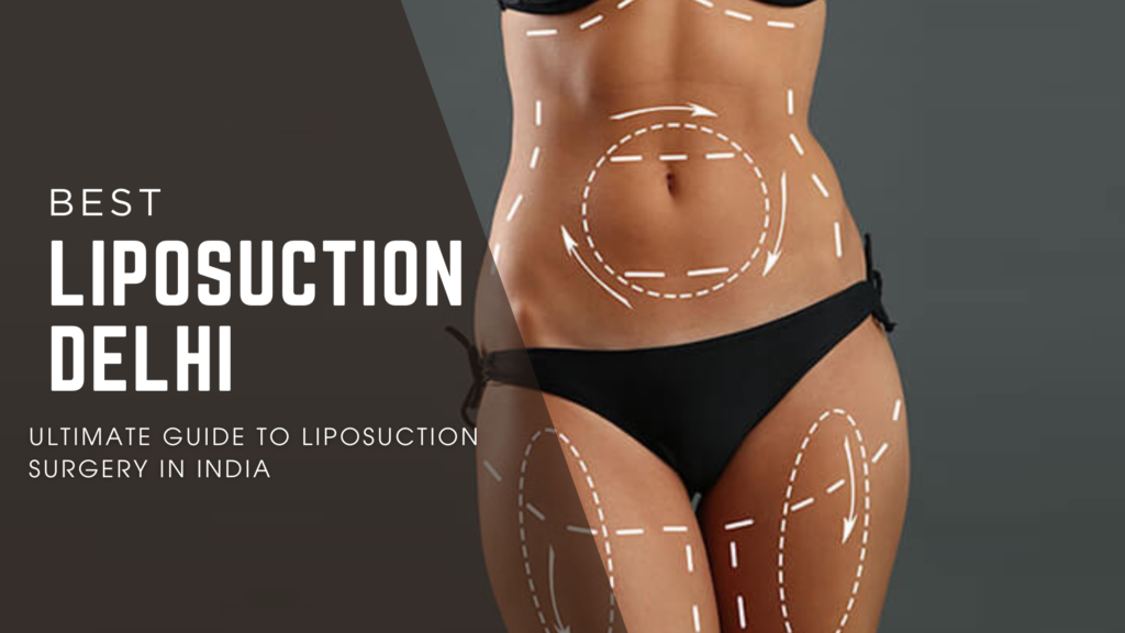#liposuction