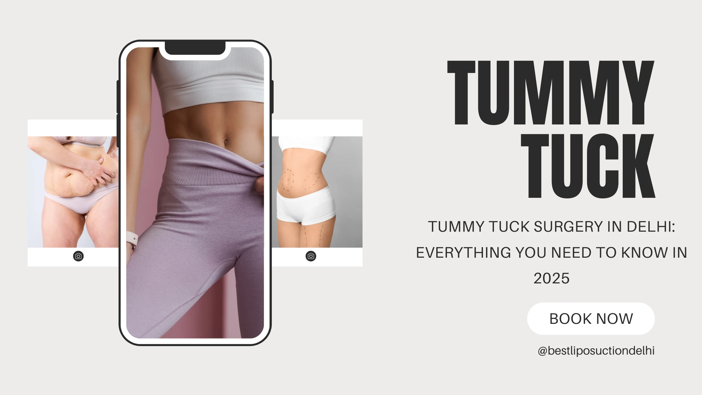 tummy tuck surgery india