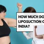 Arm Liposuction Cost in India