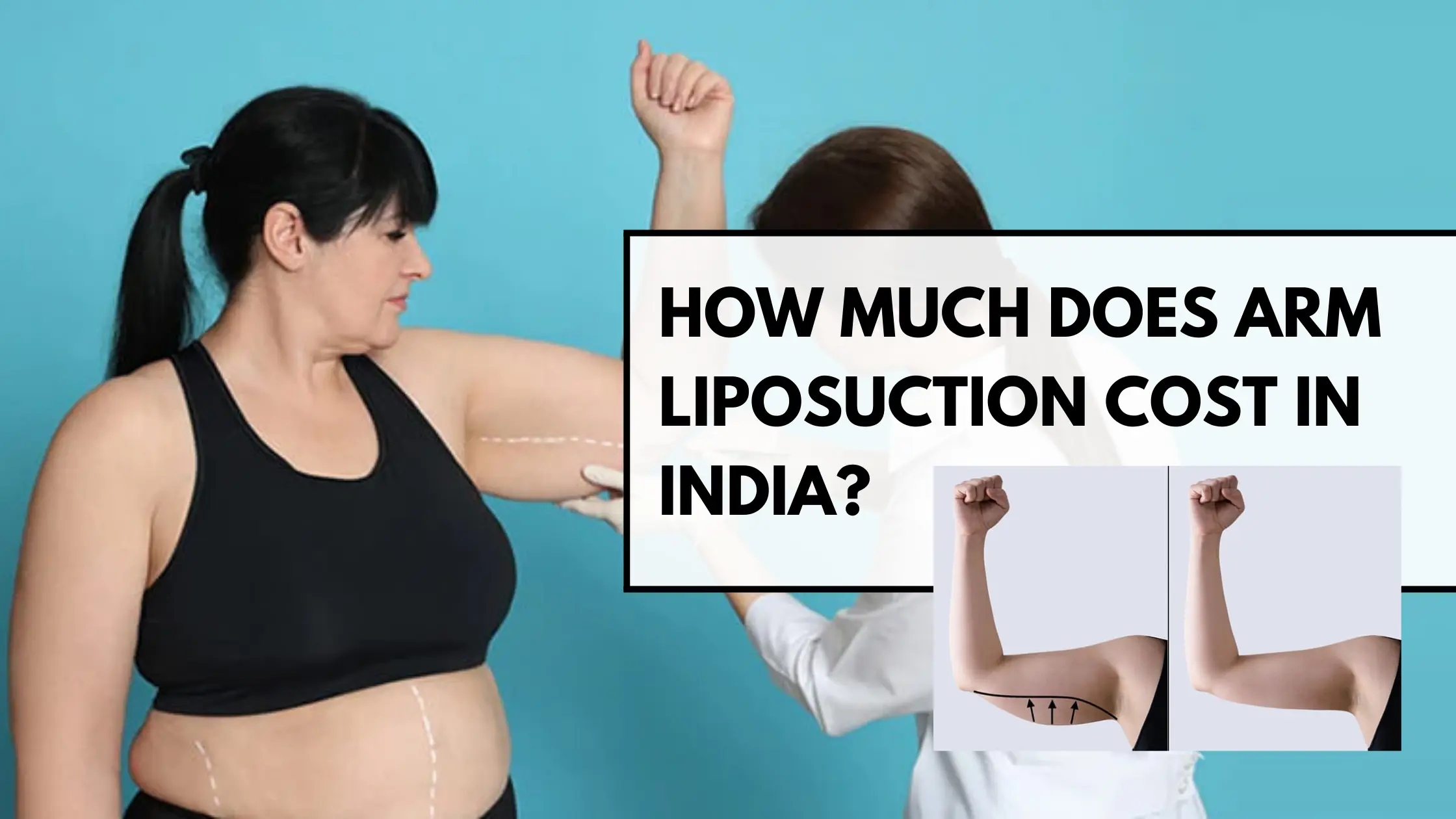 Arm Liposuction Cost in India